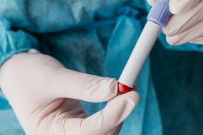 Colocación de Marcador tras Biopsia