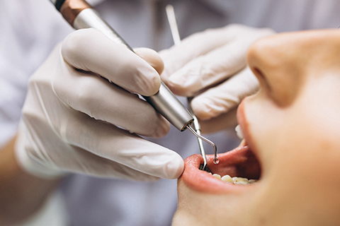 Endodoncia