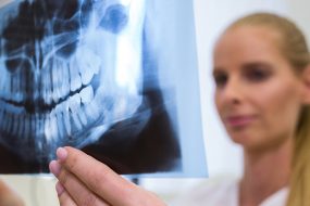 Radiografías Dentales