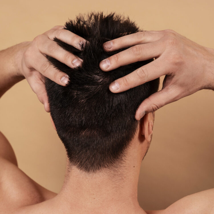 MESOTERAPIA CAPILAR