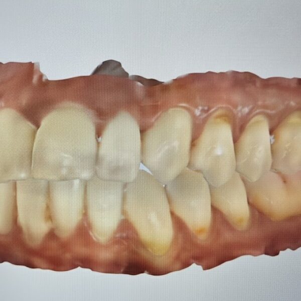 TAC Intraoral
