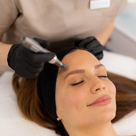 Microneedling